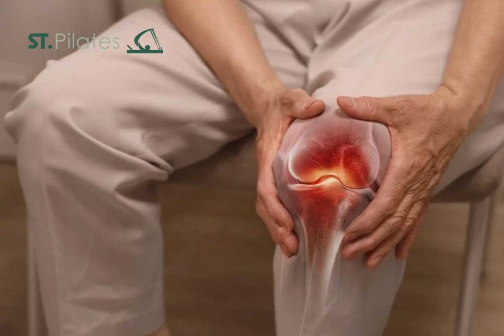پیلاتس بعد از تعویض زانو